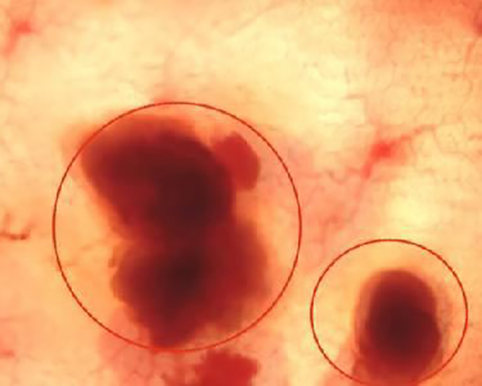 胃炎的自我自愈治疗,胃炎自愈的最快方法在家治愈