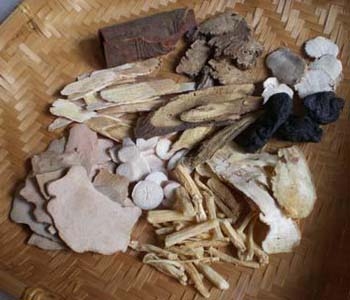 爱出汗体质的人如何防止出汗,经常出汗的人需要注意什么