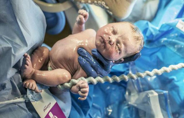 孕妇32周以后胎盘还能长上去吗,孕33周胎盘成熟2级了