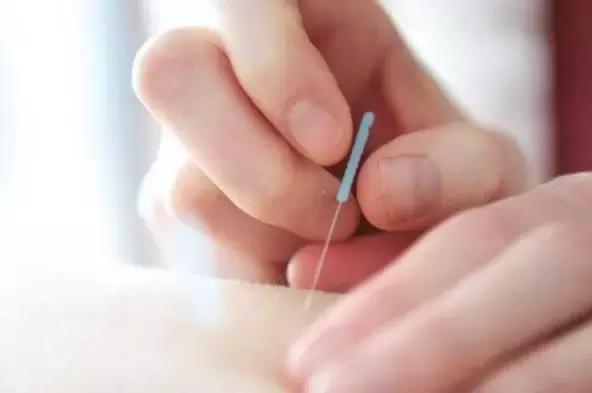 杨幂治掉头发防脱发,杨幂放血治感冒吗