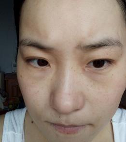 妈妈为女儿消脸上疤,妈妈为了孩子不容易