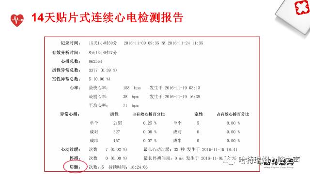 「心声」长程心电检测设备在房颤管理中的重要地位