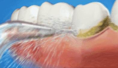 你哪儿哪儿都好，就是这点太减分了！（干货）