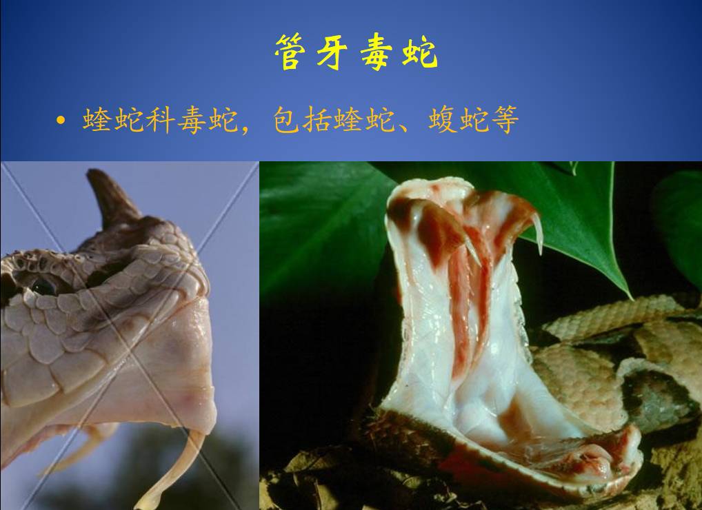 原来，这些救治毒蛇咬伤的方法都不靠谱