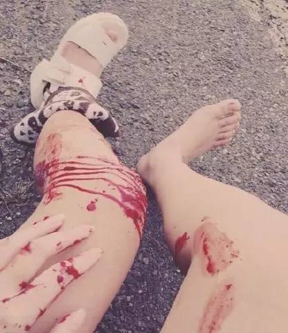 是不是傻？成都女子请病假去旅行，还发朋友圈！结果悲剧了