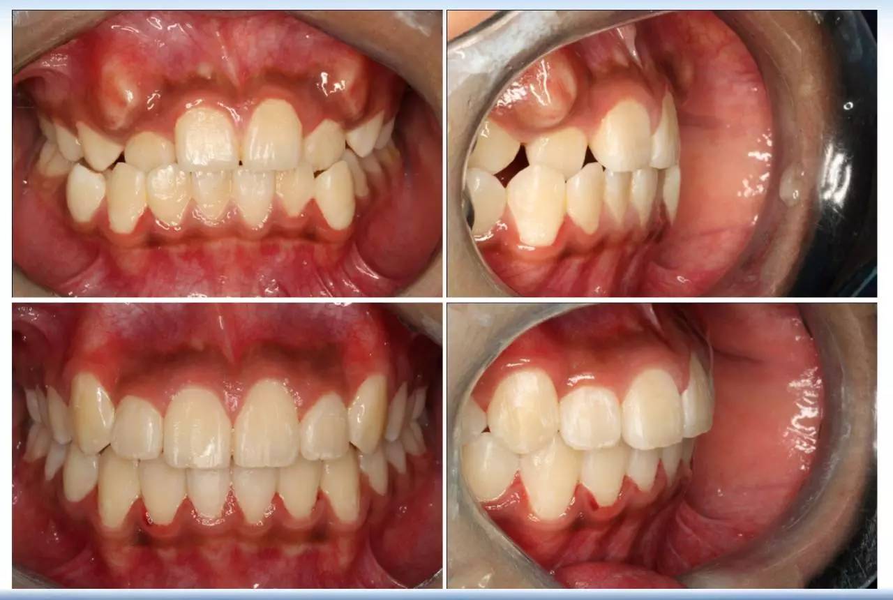 医生郭涛,正畸郭涛