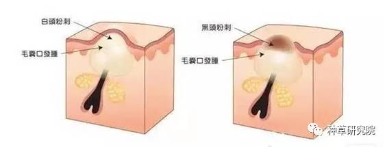 怎么才能让皮肤像水煮蛋样,如何让皮肤嫩得像剥壳的鸡蛋