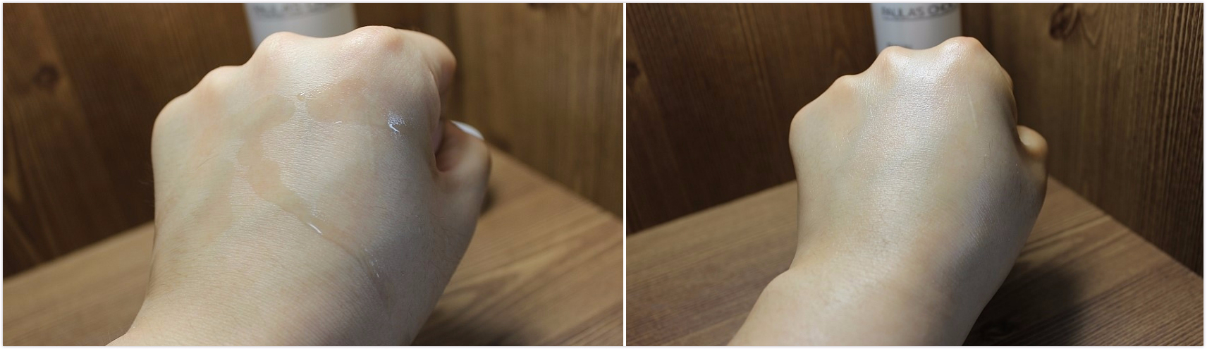 毛孔粗大怎么拯救,十滴水拯救粗大毛孔