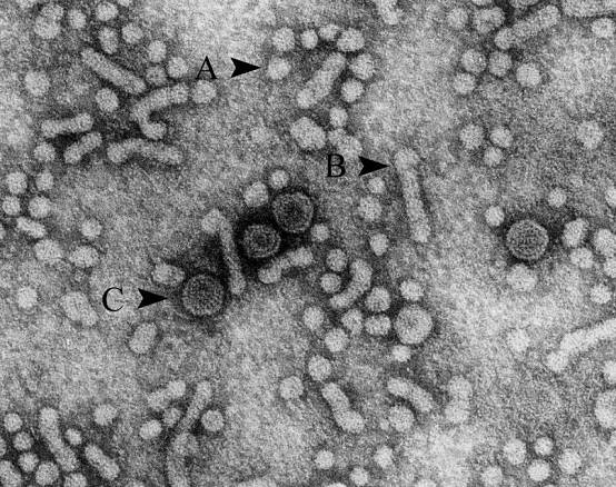 丙型肝炎病毒科普,人民医院健康科普视频