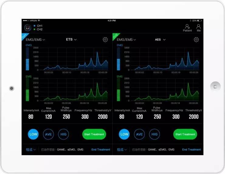 讯丰通xft肌电生物反馈仪,讯丰通第四代电刺激仪