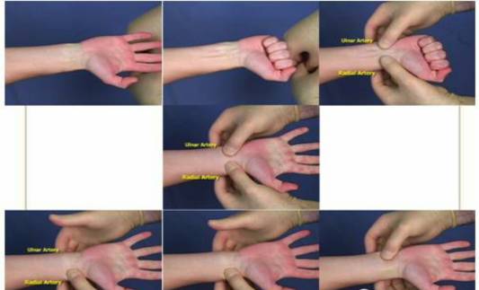 「护理宣教」小小穿刺针，实时报血压