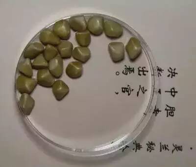 这个博物馆有点“疯狂”!2300份人体结石今天展出!就在东莞这个地方……