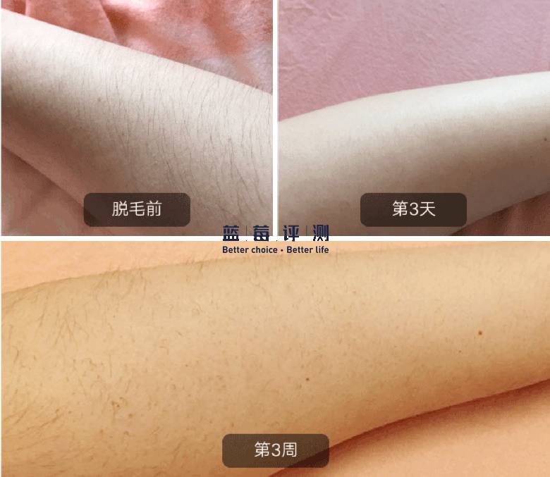 十大公认最好的美容仪,公认最好的美容仪推荐一下