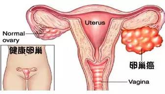 感动！巴城女大学生患癌，两天内他们竟然……