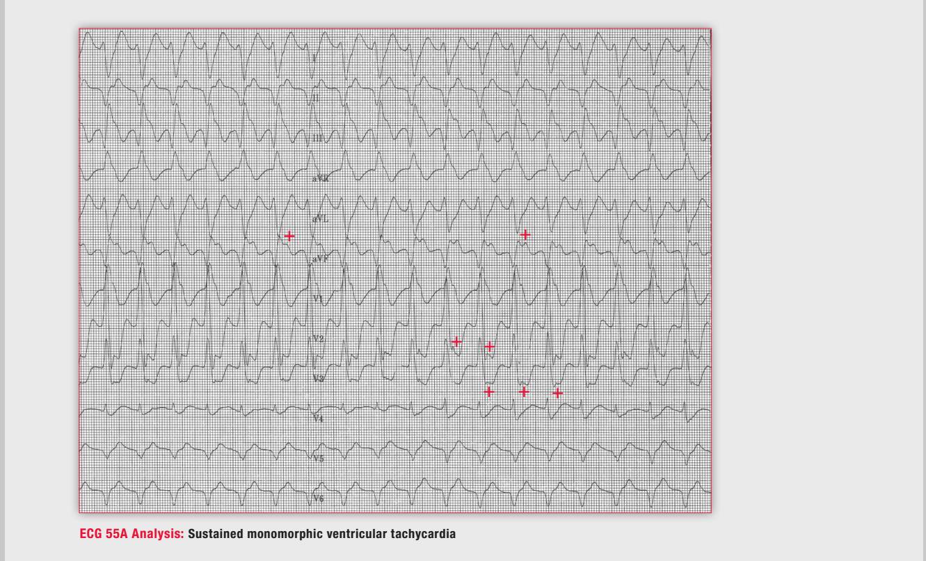 读心有术150期,读心术169
