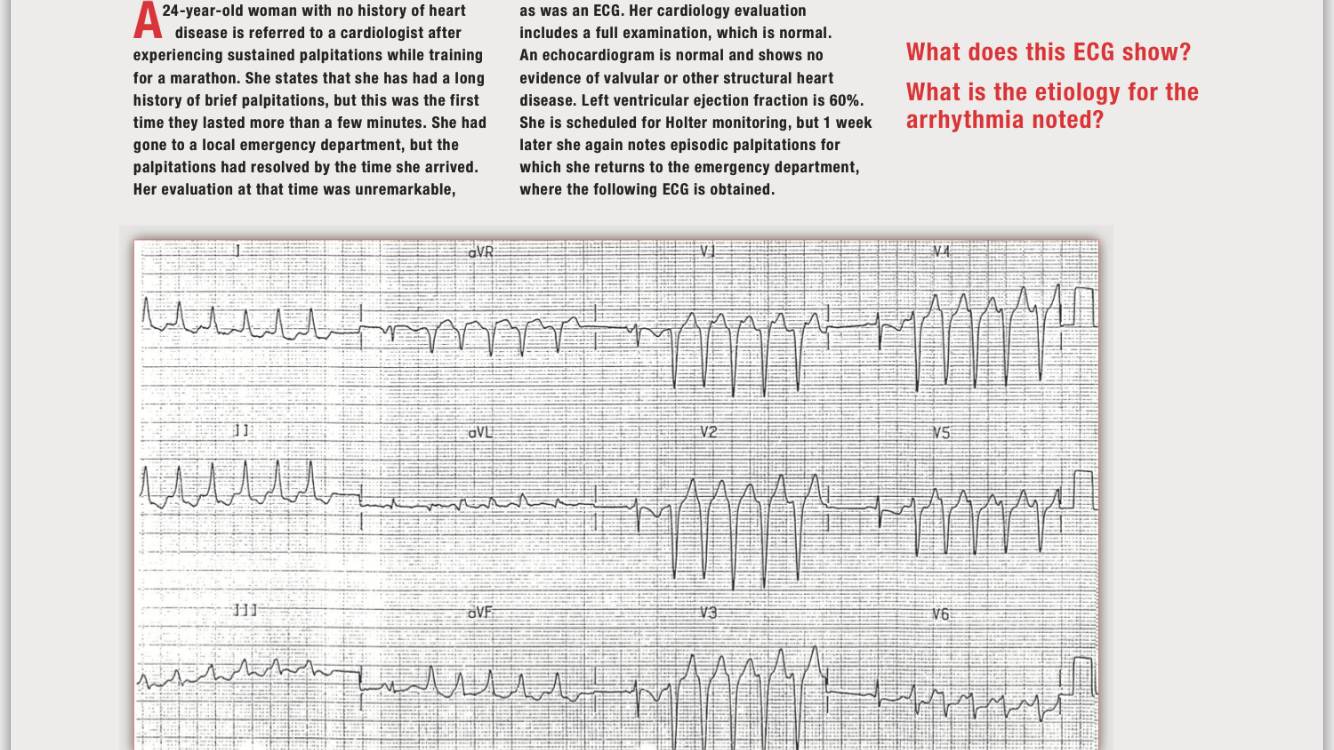 《读心有术》,读心有术265