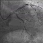 典型病例及处理方法,典型病例分析及治疗方法