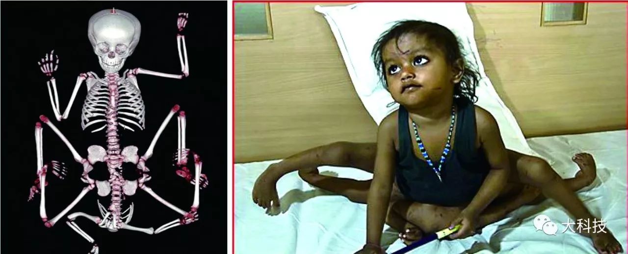 身体中能再生长的器官,身体所有器官出问题