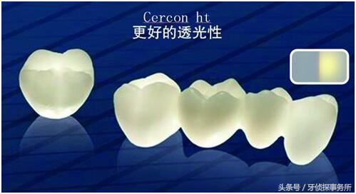 烤瓷牙和全瓷牙的区别和寿命,一颗全瓷牙冠两千贵吗