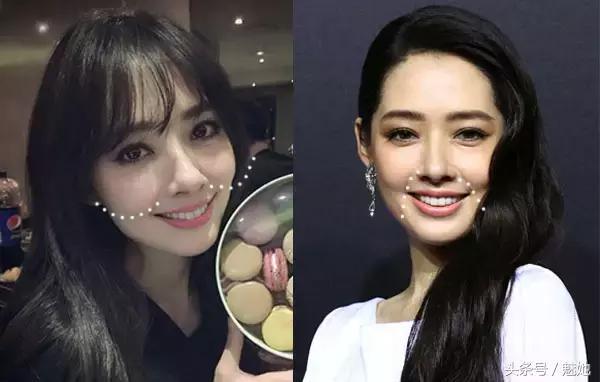 法令纹的种类和改善方法有哪些,法令纹怎么消除4妙招告别衰老