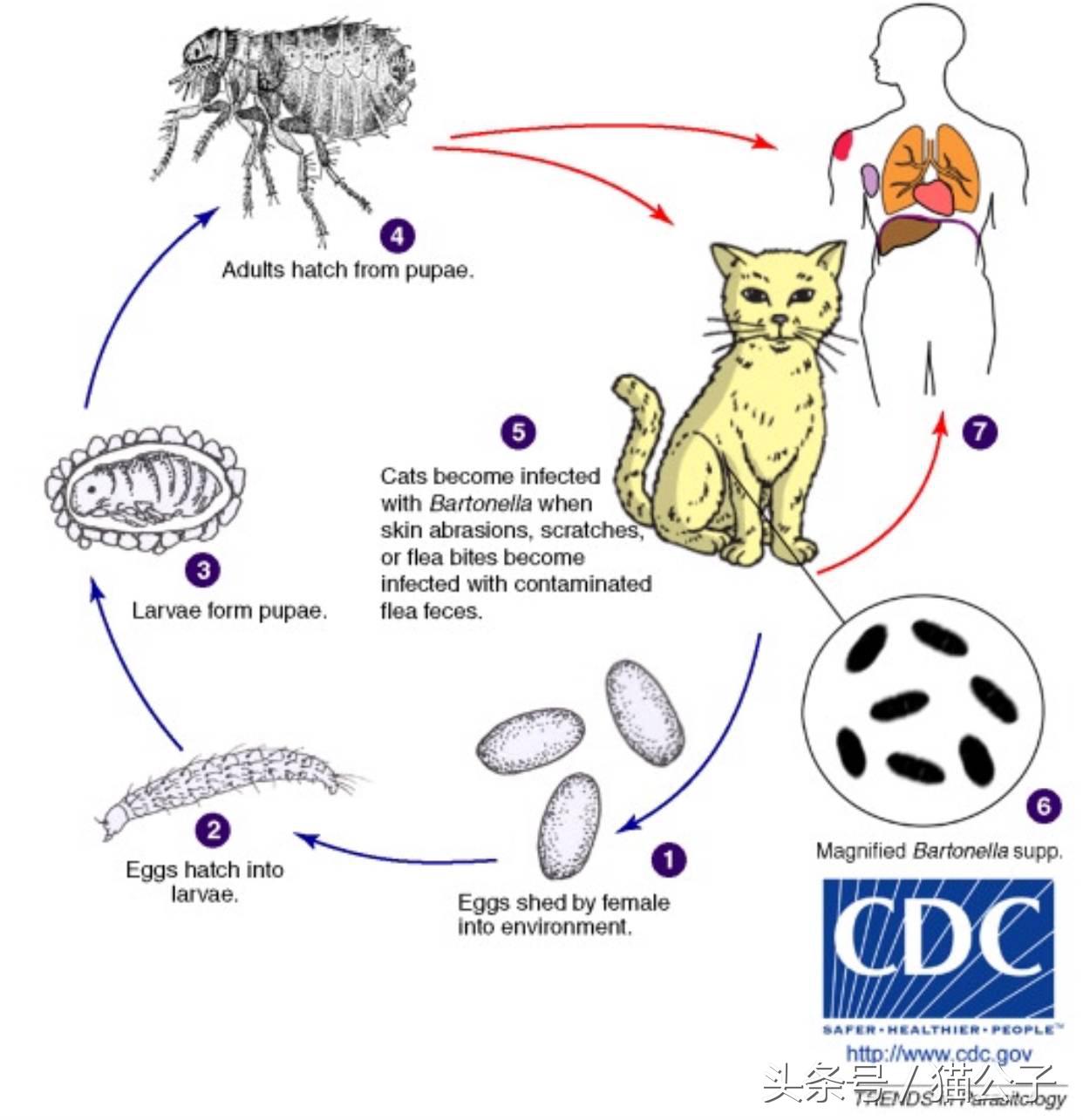 养猫会导致人得脑膜炎吗,养猫会让人得脑瘤吗