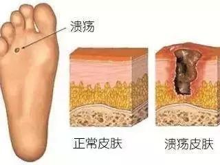 新鞋贴防磨贴,新鞋打脚创可贴