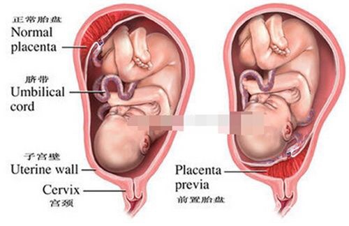 过来人的经验告诉你生二胎要趁早,二胎孕育指南详解