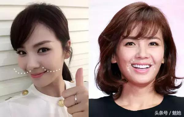 法令纹显老不用愁一招改善法令纹,法令纹的种类和改善方法有哪些