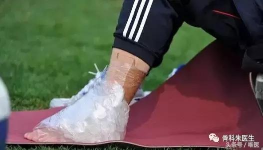 踝关节骨折没有手术怎么办,骨折保守治疗可以活动踝关节吗