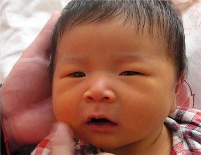 新生婴儿黄疸值偏高如何解决,新生宝宝黄疸高怎样才能降下来