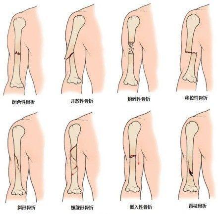 自然灾害的名称及自救自护方法,面对自然灾害应掌握哪些自救技能