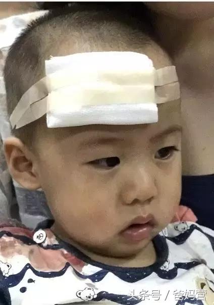 孩子摔跤到膝盖出血该怎么处理,四岁孩子摔跤缝了22针