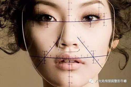 颧骨突出截骨手术的全过程,颧骨截骨多久恢复