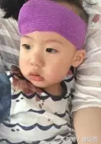 2岁宝宝摔跤手指破皮出血,小孩子摔跤出血去医院缝针