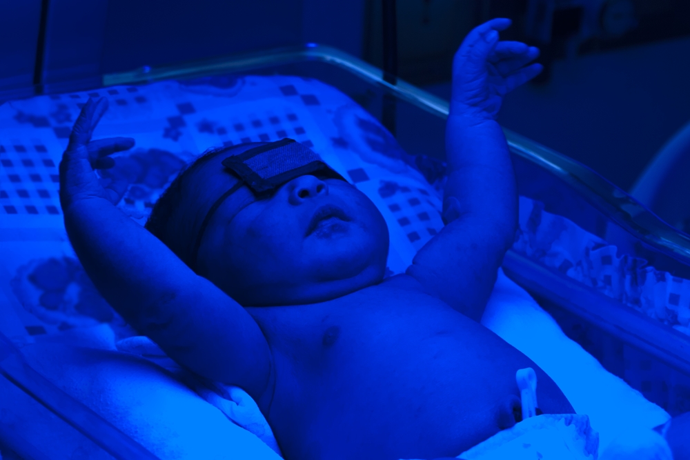 新生婴儿黄疸值偏高如何解决,新生宝宝黄疸高怎样才能降下来