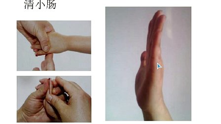 脾虚湿盛型湿疹小儿推拿穴位,小儿推拿后起湿疹是排毒反应吗