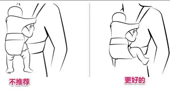 宝宝腿纹不对称是拍ct还是彩超,腿纹不对称但是双腿蹬起来很有力