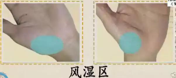 手是人体的重要器官,手上的健康秘密