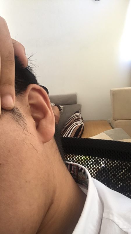 耳朵上有个小孔但是不通,耳朵上有个小孔说法