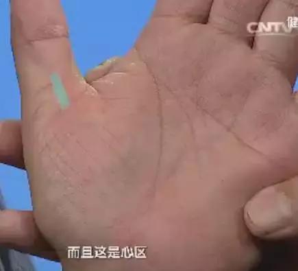手是人体的重要器官,手的颜色能看出健康的问题吗