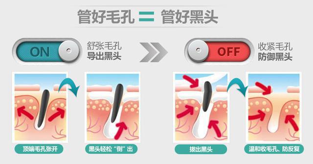 毛孔管理哪里可以做,毛孔管理臻美