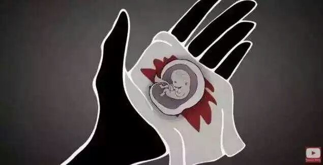 男的会接受女朋友打胎吗,你会建议你的女朋友打胎吗