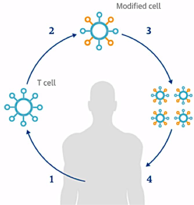 打造一部冲向癌细胞的战车：肿瘤免疫疗法之CAR-T细胞疗法