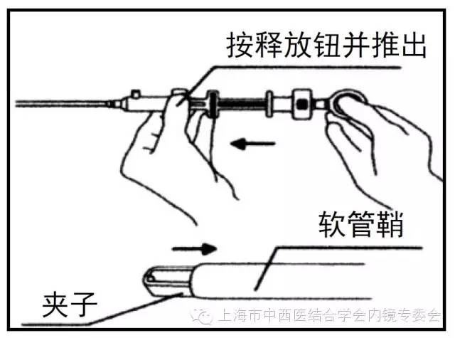 消化内镜仪器操作,消化内镜护理操作名称