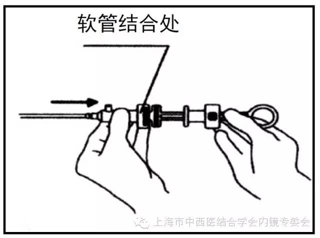 消化内镜仪器操作,消化内镜护理操作名称