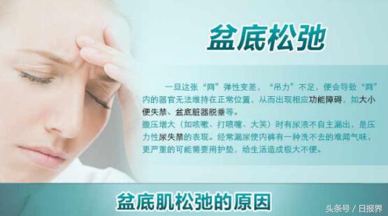 kegel盆底康复仪领军家用盆底康复产品