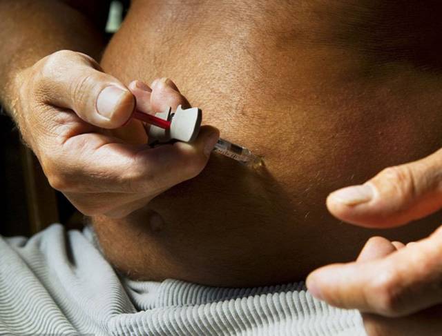 呼气中有烂苹果味是什么病,口中有苹果味是什么原因