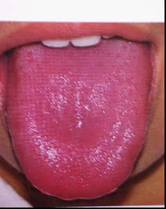 老中医看一眼就知道男子有病,老中医是如何看出某人有肛裂的