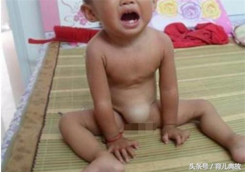 一个月的宝宝肚脐上有点鼓,两个月宝宝肚脐凸起按压有水声