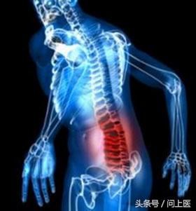 自身免疫性疾病的最新疗法,自身免疫性疾病吃什么药